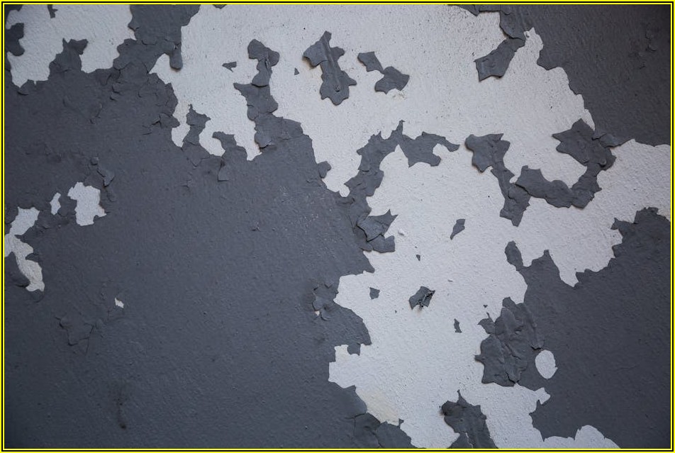 종골 골절 치료, 어떤 병원 가야 할까?