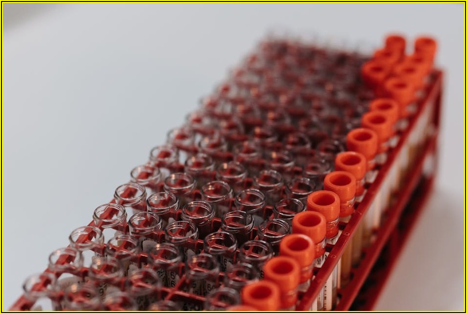 후회 없는 실버랙 구매: 튼튼함과 실용성을 위한 꿀팁