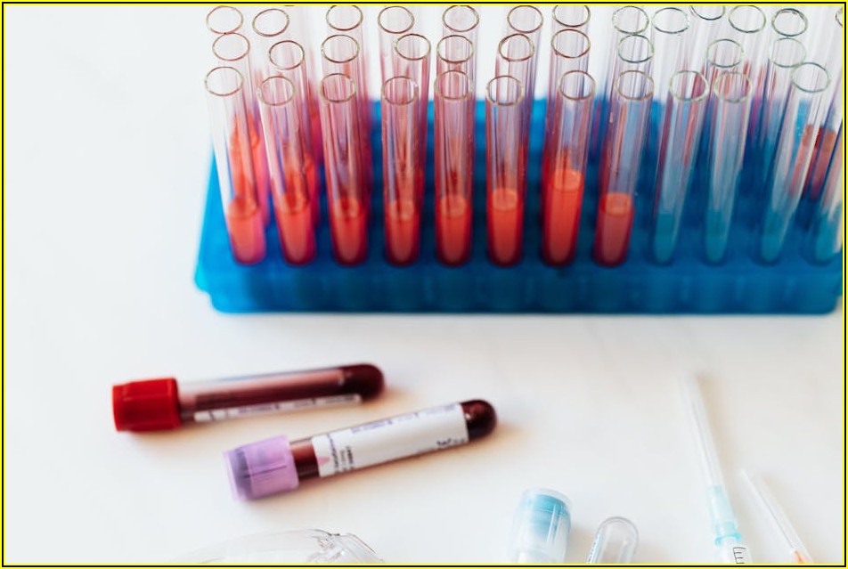 나를 알면 스트레스 끝, 기질 검사 활용법